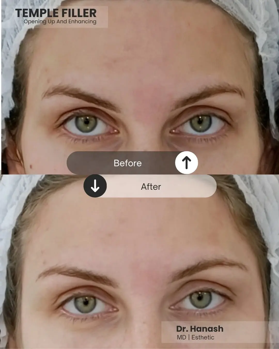 Nu Yu MediSpa aesthetic treatment